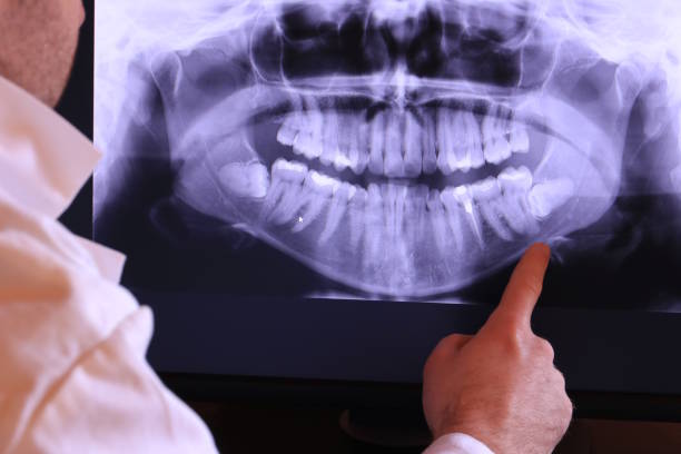 Best Emergency Treatment for Toothache in Queen City, TX