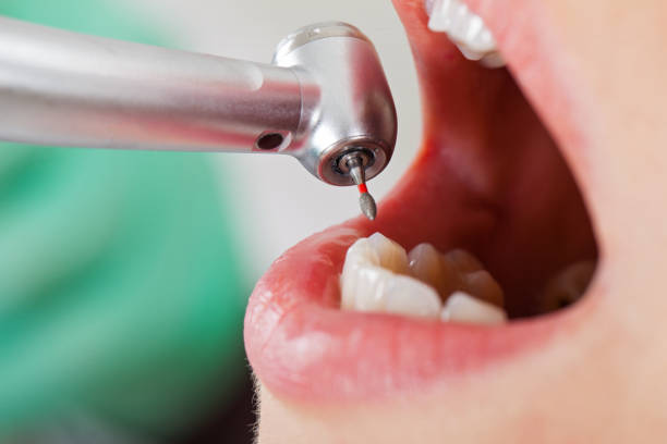 Best Pediatric Emergency Dentist in Queen City, TX